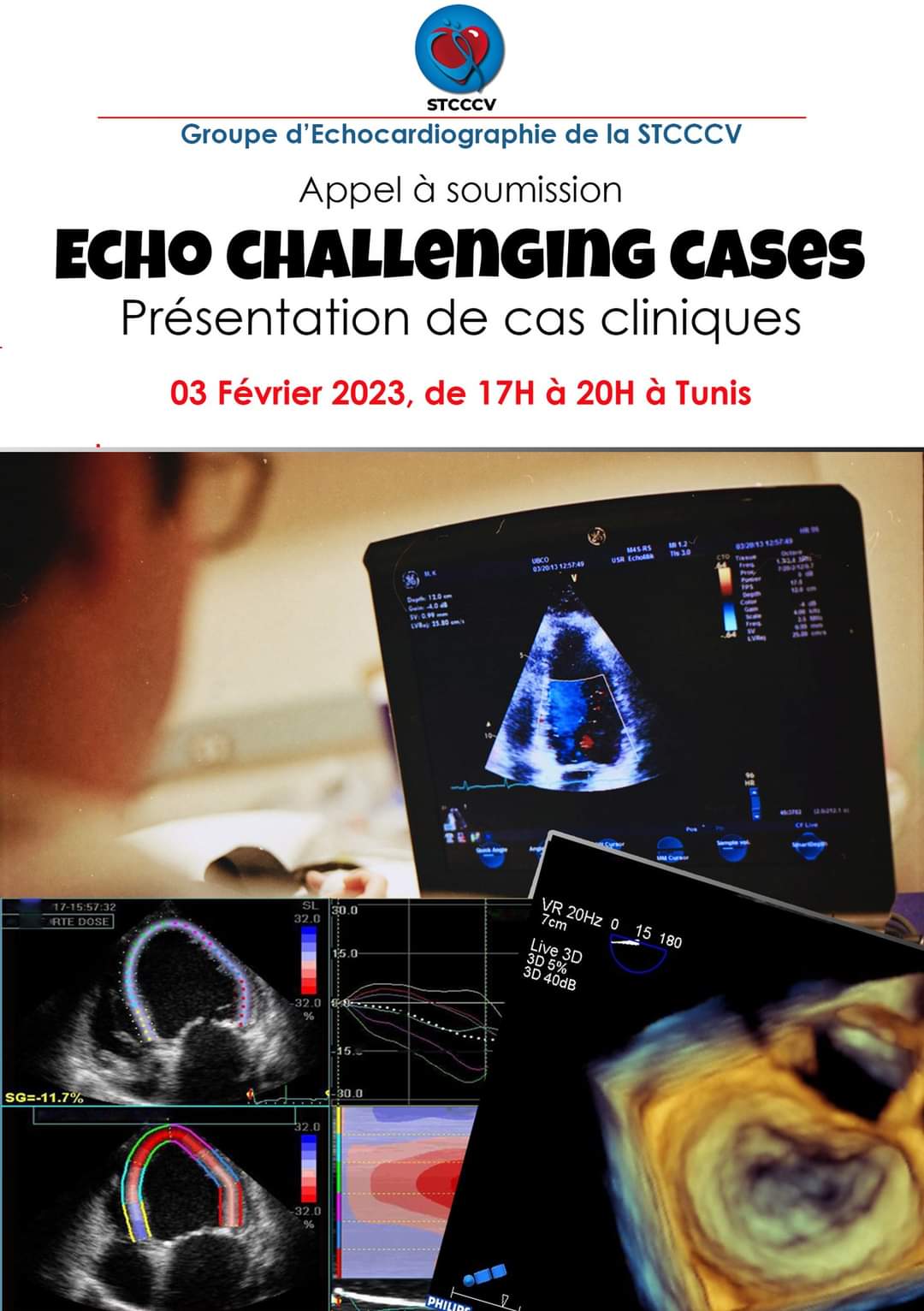 Echo Challenging Cases